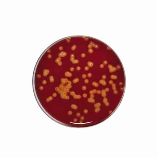 Biokar BLOOD AGAR (BASE) 500g BK028HA